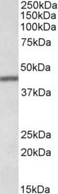 Western Blot: TFB2M Antibody [NBP1-78283]