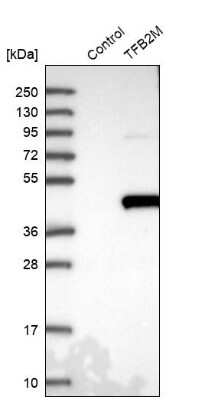 Western Blot: TFB2M Antibody [NBP1-82114]