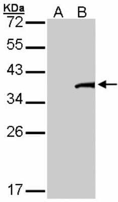 Western Blot: TFB2M Antibody [NBP2-20608]