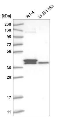 Western Blot: TFB2M Antibody [NBP2-55095]