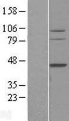 Western Blot: TFB2M Overexpression Lysate [NBL1-16832]