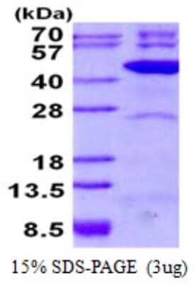 SDS-PAGE: Recombinant Human TFB2M His Protein [NBP2-22878]