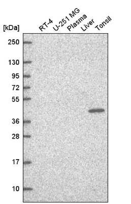 Western Blot: TFCP2 Antibody [NBP2-55972]