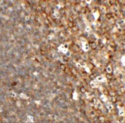 Immunohistochemistry: TFCP2L1 Antibody - BSA Free [NBP2-82042]
