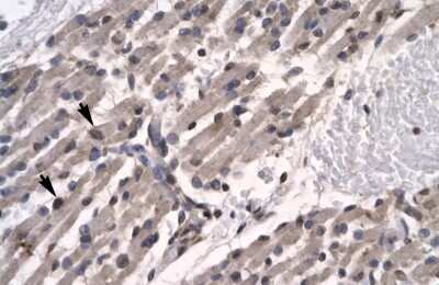 Immunohistochemistry: TFCP2L1 Antibody [NBP3-10920]