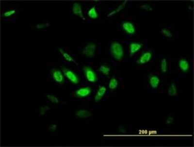 Immunocytochemistry/ Immunofluorescence: TFDP3 Antibody (1F11) [H00051270-M01]