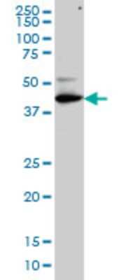 Western Blot: TFDP3 Antibody (1F11) [H00051270-M01]