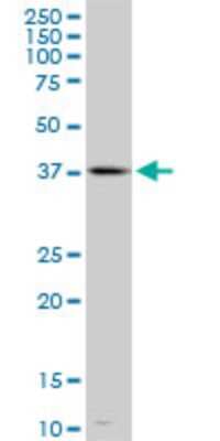 Western Blot: TFDP3 Antibody (3F11) [H00051270-M02]