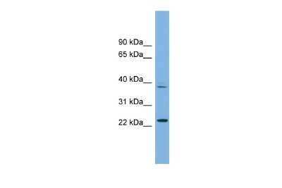 Western Blot: TFDP3 Antibody [NBP2-86858]