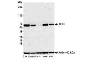 Western Blot: TFEB Antibody (BLR070G) [NBP2-77360]