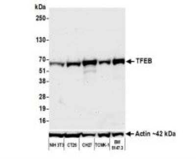 Western Blot: TFEB Antibody (BLR070G) [NBP2-77360]