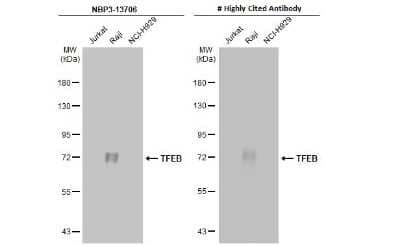 Western Blot: TFEB Antibody (HL1065) [NBP3-13706]