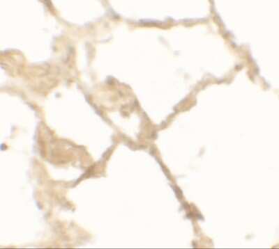 Immunohistochemistry-Paraffin: TFEB Antibody - BSA Free [NBP2-41168]