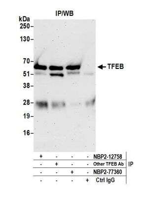 Immunoprecipitation: TFEB Antibody [NBP2-12758]