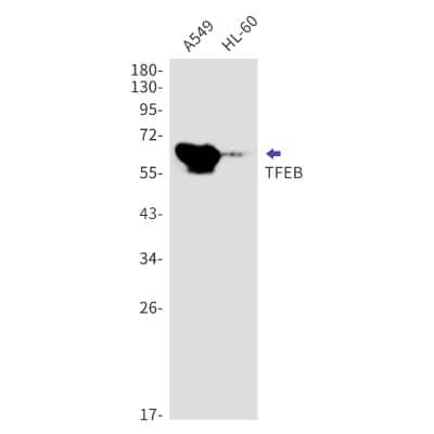 Western Blot: TFEB Antibody (S05-0D7) [NBP3-14901]