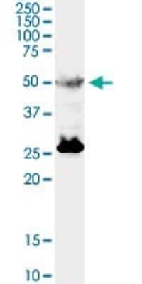 Western Blot: TFEB Antibody (S1) [H00007942-M01]