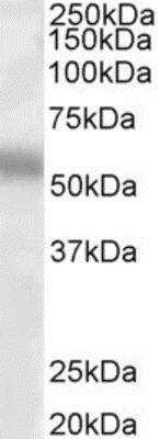 Western Blot: TFEB Antibody [NB100-93447]