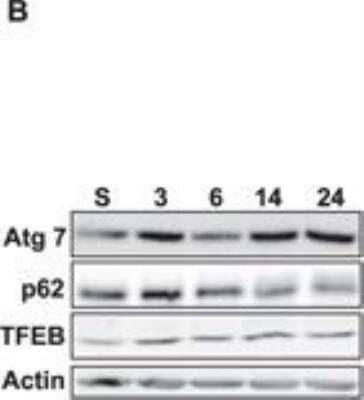 Western Blot: TFEB Antibody [NB100-93447]