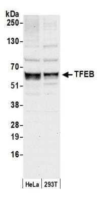 Western Blot: TFEB Antibody [NBP2-12758]