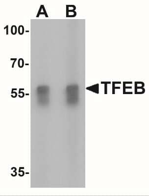 Western Blot: TFEB AntibodyBSA Free [NBP2-41167]