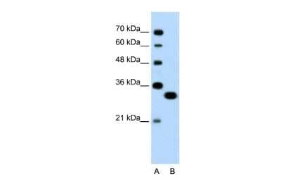 Western Blot: TFEC Antibody [NBP3-10931]