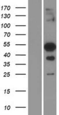 Western Blot: TFEC Overexpression Lysate [NBP2-08676]