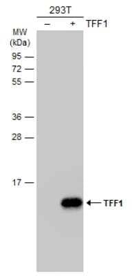 Western Blot: TFF1/pS2 Antibody [NBP2-16376]