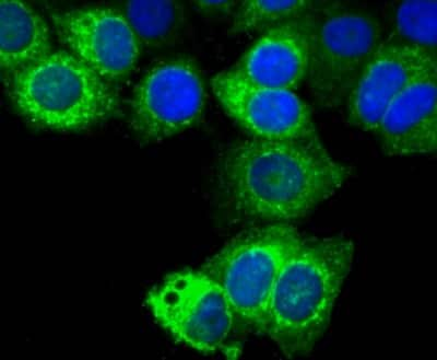 Immunocytochemistry/ Immunofluorescence: TFF1/pS2 Antibody (JM37-86) [NBP2-75681]