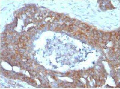 Immunohistochemistry: TFF1/pS2 Antibody (PS2GE2) - BSA Free [NBP2-50275]