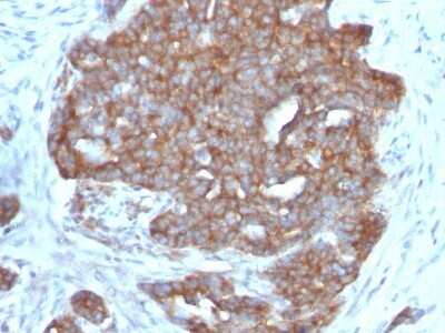 Immunohistochemistry-Paraffin: TFF1/pS2 Antibody (SPM573) - Azide and BSA Free [NBP2-34806]