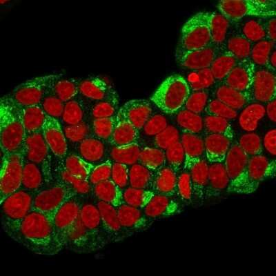 Immunocytochemistry/ Immunofluorescence: TFF1/pS2 Antibody (TFF1/2133) [NBP3-07341]