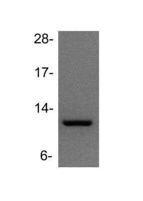 Western Blot: TFF1/pS2 Antibody [NBP1-90813]