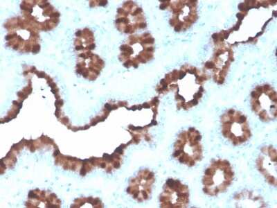 Immunohistochemistry-Paraffin: TFF1/pS2 Antibody (rTFF1/1091) - Azide and BSA Free [NBP3-08248]