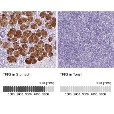 Immunohistochemistry-Paraffin: TFF2 Antibody [NBP2-34032]