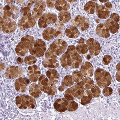 Immunohistochemistry-Paraffin: TFF2 Antibody [NBP2-34032]