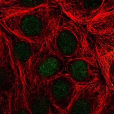 Immunocytochemistry/ Immunofluorescence: TFF3 Antibody [NBP2-34007]