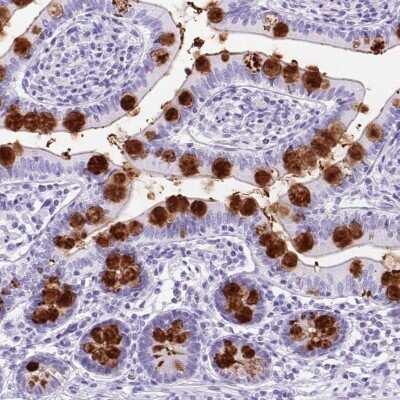 Immunohistochemistry-Paraffin: TFF3 Antibody [NBP2-34007]