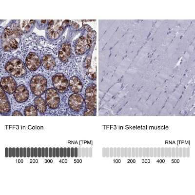 Immunohistochemistry-Paraffin: TFF3 Antibody [NBP2-34007]