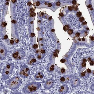 Immunohistochemistry-Paraffin: TFF3 Antibody [NBP2-34007]
