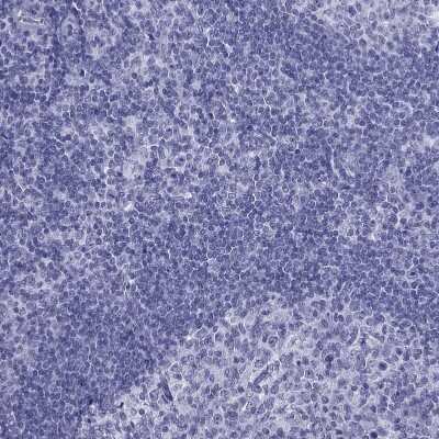 Immunohistochemistry-Paraffin: TFF3 Antibody [NBP2-34007]