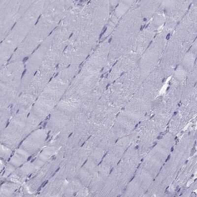 Immunohistochemistry-Paraffin: TFF3 Antibody [NBP2-34007]