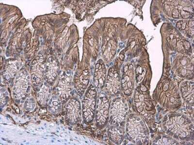 Immunohistochemistry-Paraffin: TFF3 Antibody [NBP3-13358]