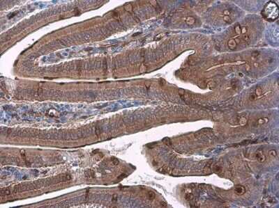 Immunohistochemistry-Paraffin: TFF3 Antibody [NBP3-13358]