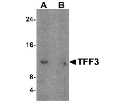 Western Blot: TFF3 AntibodyBSA Free [NBP1-76514]