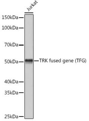 Western Blot: TFG Antibody (0V5P10) [NBP3-15484]