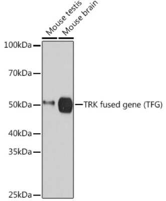 Western Blot: TFG Antibody (0V5P10) [NBP3-15484]