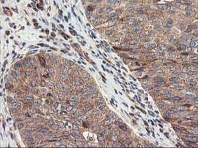 Immunohistochemistry-Paraffin: TFG Antibody (OTI2C3) [NBP2-01438]