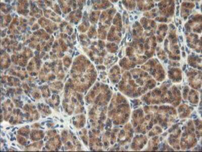 Immunohistochemistry-Paraffin: TFG Antibody (OTI2C3) [NBP2-01438]