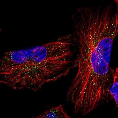 Immunocytochemistry/ Immunofluorescence: TFG Antibody [NBP1-81957]