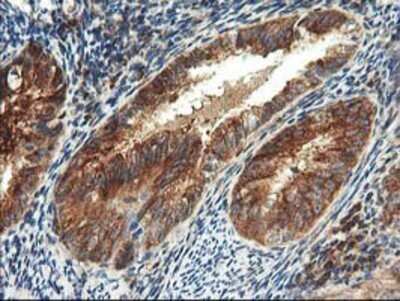 Immunohistochemistry: TFG Antibody (OTI2C3) - Azide and BSA Free [NBP2-74491]